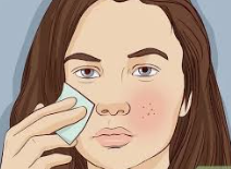How to Get Rid of Large Pores, oily face